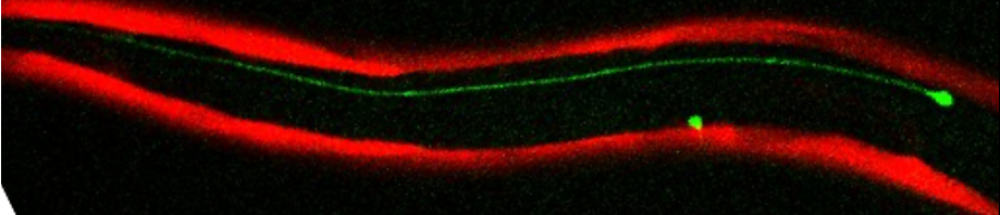 C elegans expressing mCherry in muscle and GFP in ALM neuron